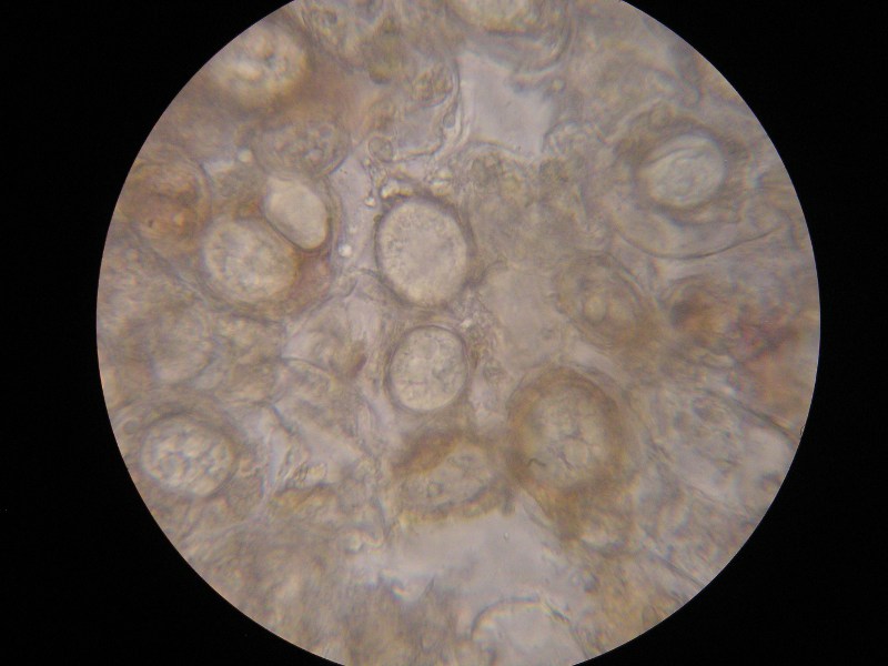 1000er Piller (1).JPG