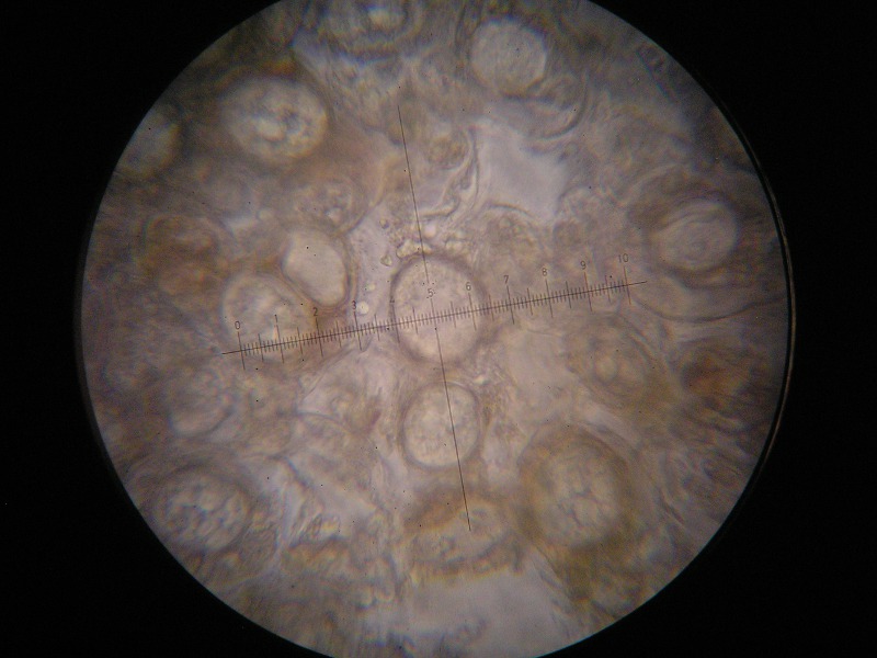 1000er Piller (5).JPG