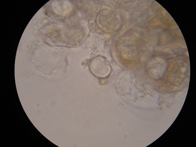 1000er Piller (7).JPG