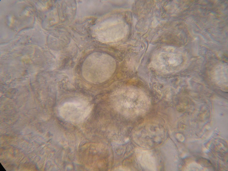 1000er Piller (14).JPG