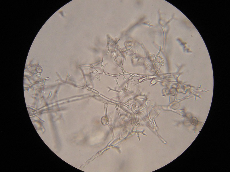 400er Eckern (1).JPG