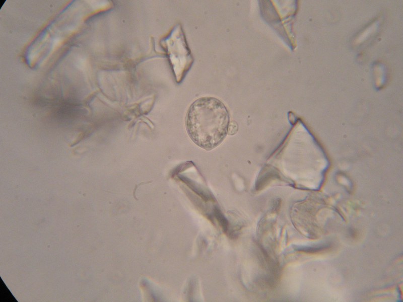 1000er Eckern (2).JPG