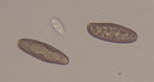 Gomphidius maculatus_Sporen_1.1.JPG