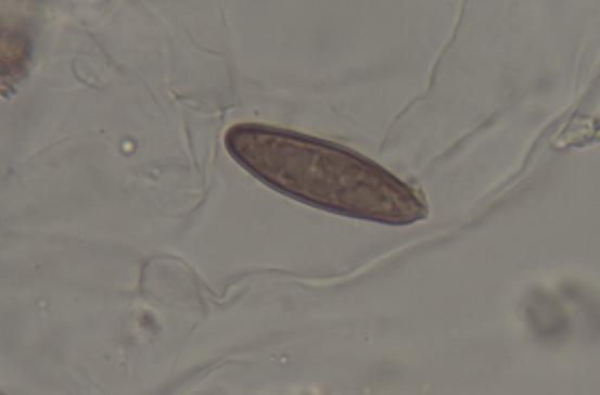 Gomphidius maculatus_Sporen_1.2.JPG