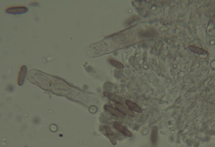 Gomphidius maculatus_Zystide_1.JPG