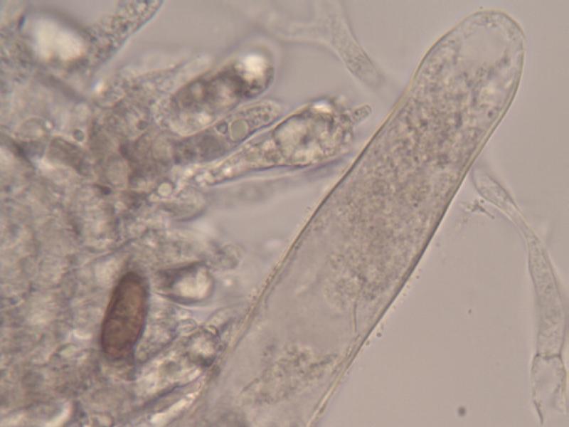 Gomphidius maculatus_Zystide_2.JPG