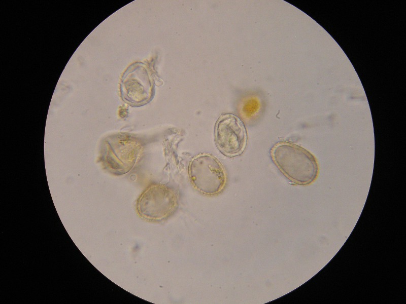 1000er Rachel (33).JPG