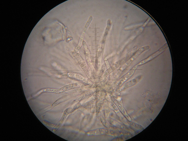 1000er Aschau (2).JPG