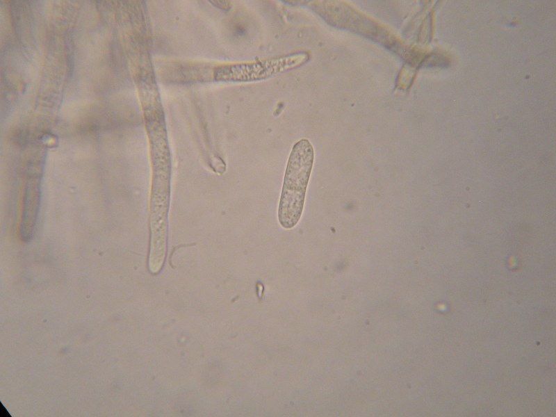 1000er Aschau (4).JPG