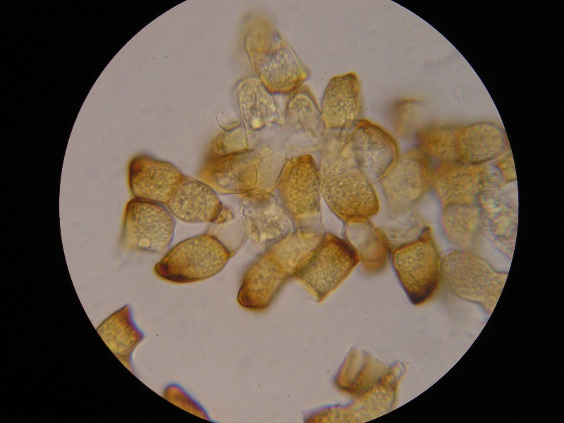 1000er Zwiesel (12).JPG