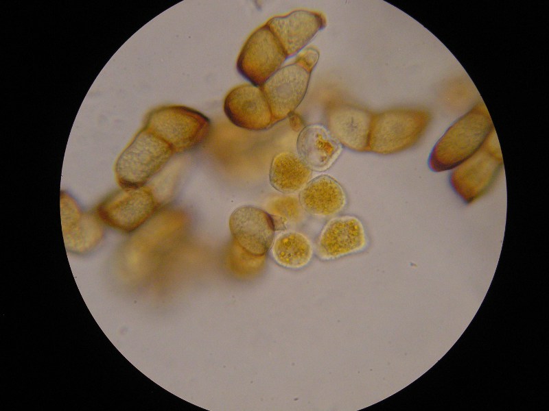 1000er Zwiesel (20).JPG