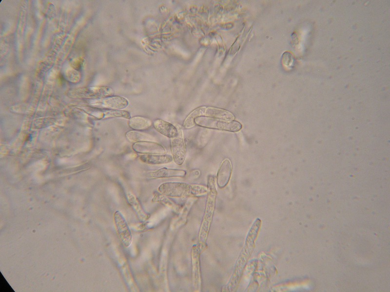 1000er Zwiesel (9).JPG