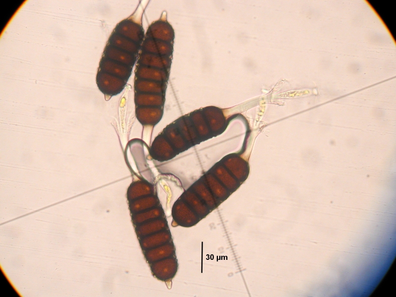 Phragmidium III-Teliosporen auf Rubus amphimalacus