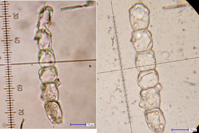 Kuehneola uridinis III-Teleutosporen auf Rubus ambulans.jpg