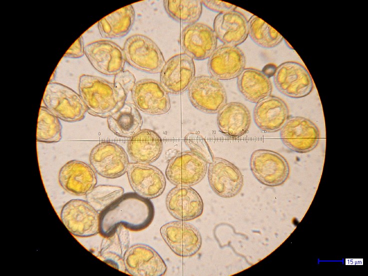 Kuehneola uridinis II-Sekundäre Uredosporen auf Rubus ambulans 2.jpg