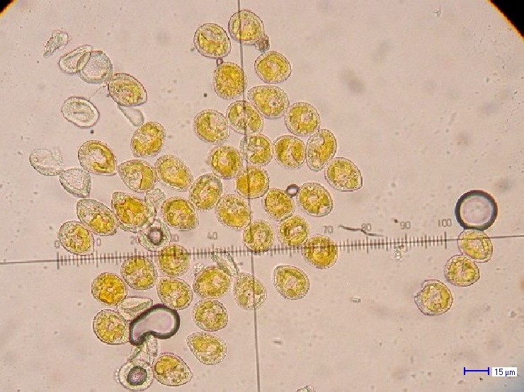 Kuehneola uridinis II-Sekundäre Uredosporen auf Rubus ambulans 1.jpg