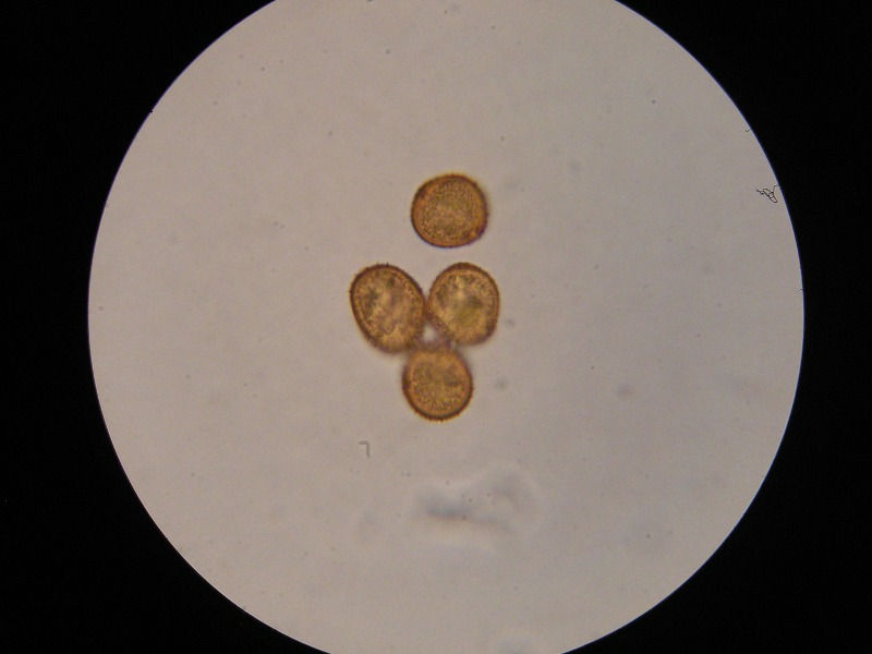 1000er Scheiden (3).JPG