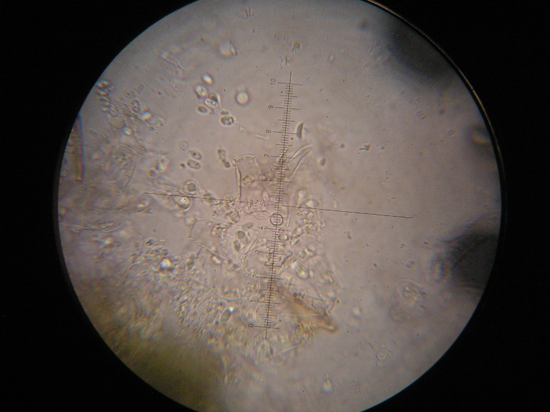 1000er Grabfeld (4).JPG