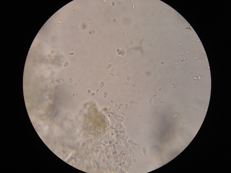 1000er Grabfeld (7).JPG