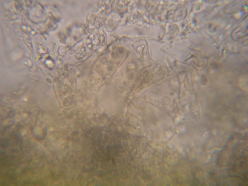 1000er Grabfeld (14).JPG