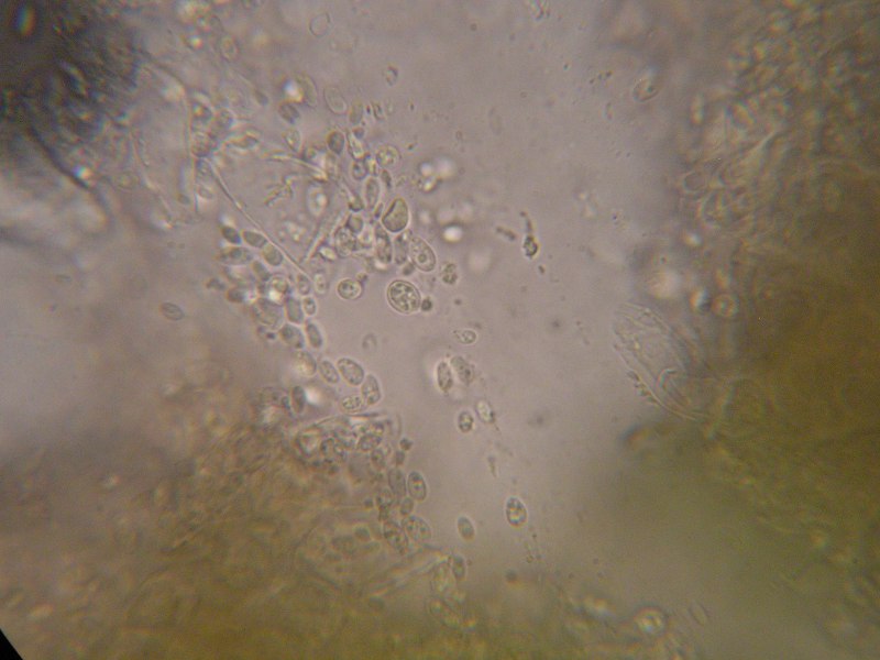 1000er Grabfeld (18).JPG