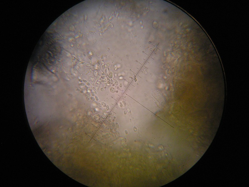 1000er Grabfeld (19).JPG