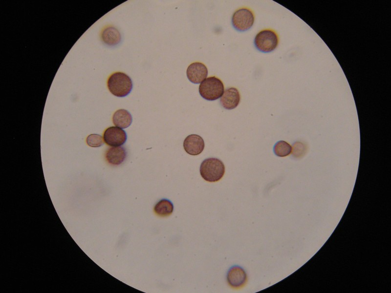 Microbotryum marginale-Bistorta officinale (5).JPG