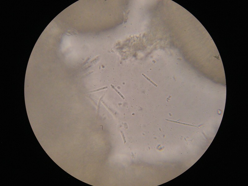 1000er Scheiden (10).jpg