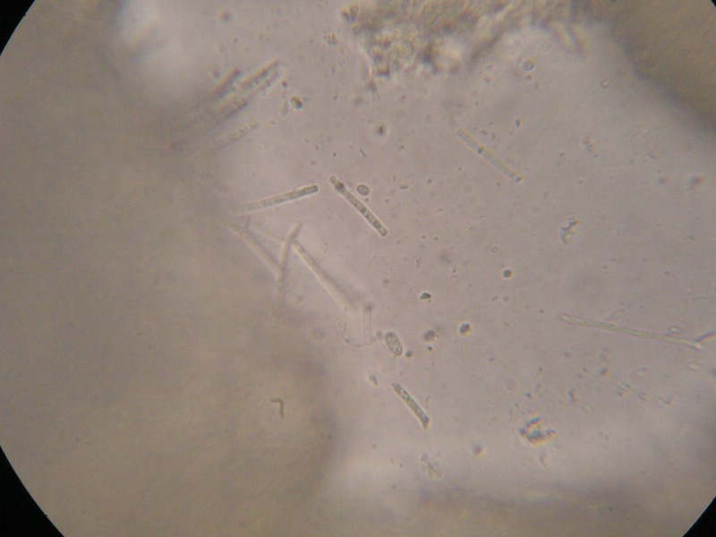 1000er Scheiden (2).jpg