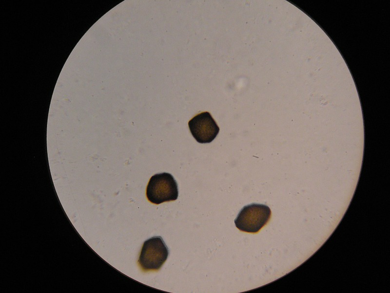 1000er Hundstod (11).JPG