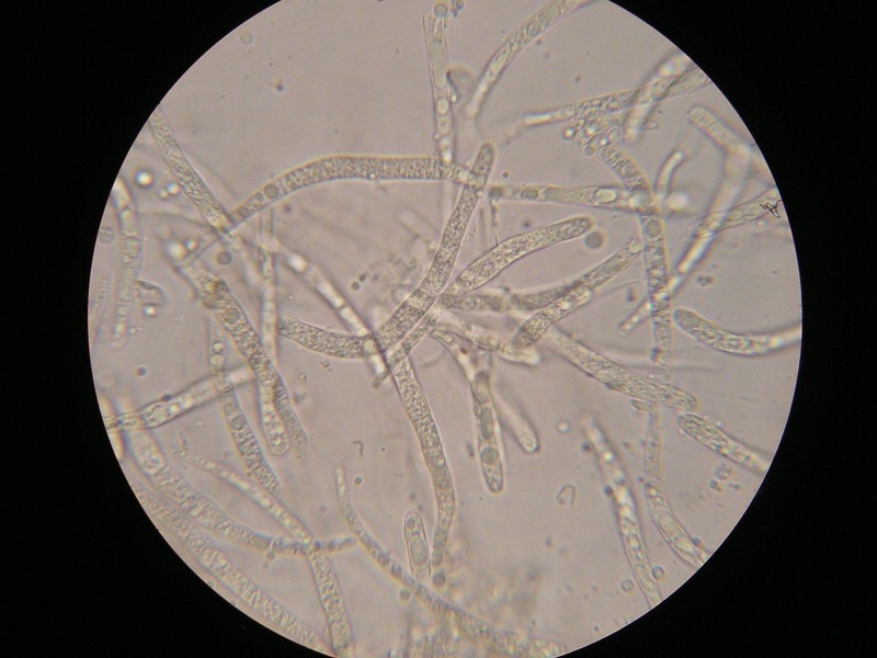 1000er Scheiden (20).jpg