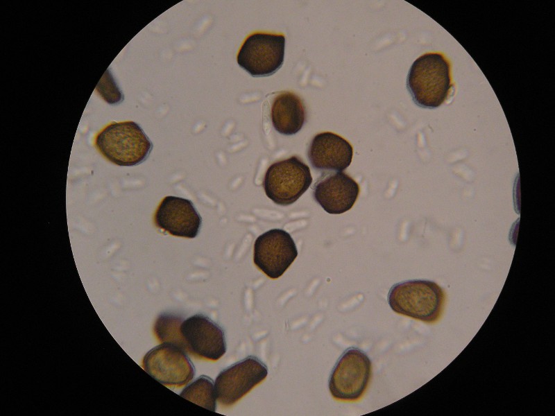 1000er Berchtes (2).JPG