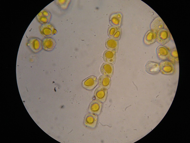 1000er Enzian (3).jpg