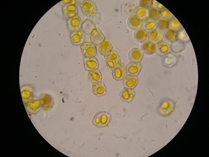 1000er Enzian (10).jpg