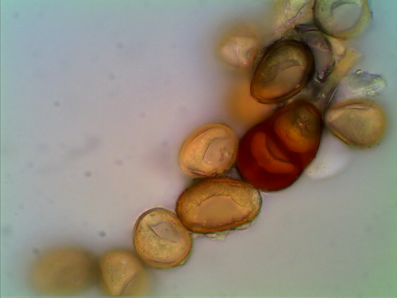 Puccinia polygoni amphibii DE 1000 02 stack.jpg