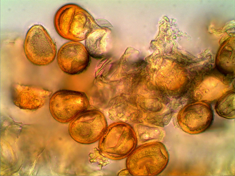 Puccinia polygoni amphibii DE 1000 03 stack.jpg