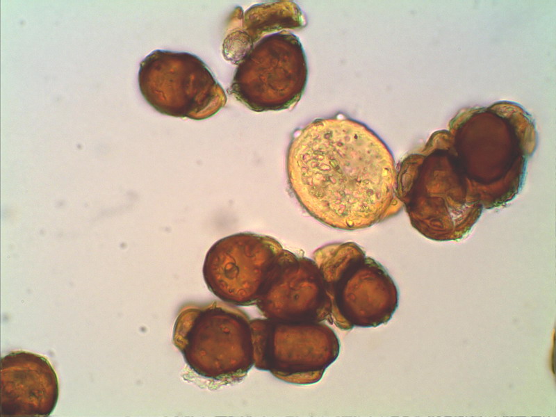 Urocystis anomones DE 210407 1000 01stack.jpg