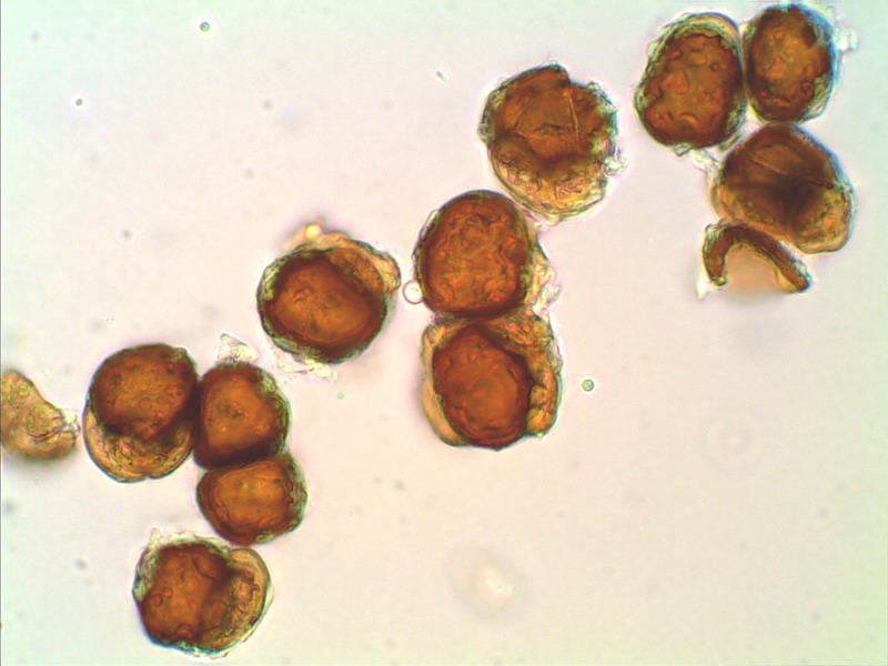 Urocystis anomones DE 210407 1000 02 stack.jpg
