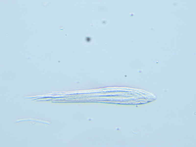 RhytismaAcerinum013x800.JPG