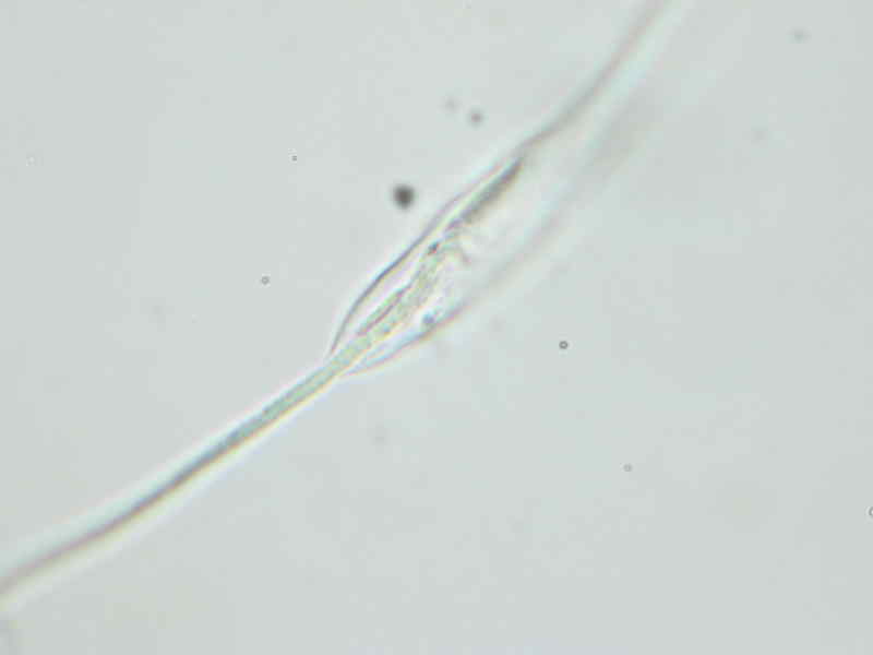 RhytismaAcerinum019x800.JPG