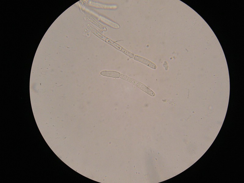 1000er Berchtes (17).jpg