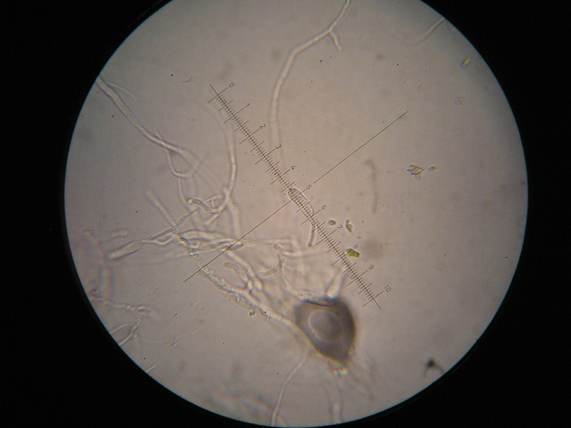 1000er Berchtes (3).jpg