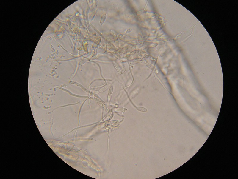 1000er Berchtes (10).jpg