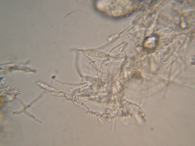 1000er Berchtes (17).jpg