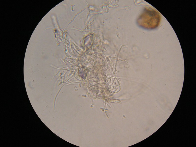 1000er Berchtes (19).jpg