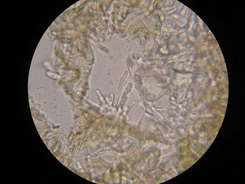 1000er Berchtes (19).jpg