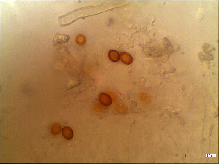 Messbild_Rindenpilz stack_01072013.jpg