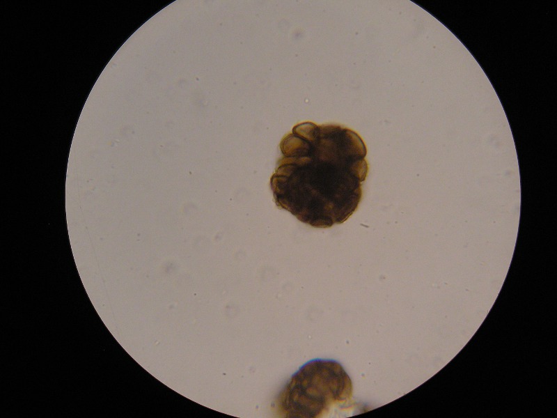 Urocystis_luzulae_Luzula_glabrata (3).JPG