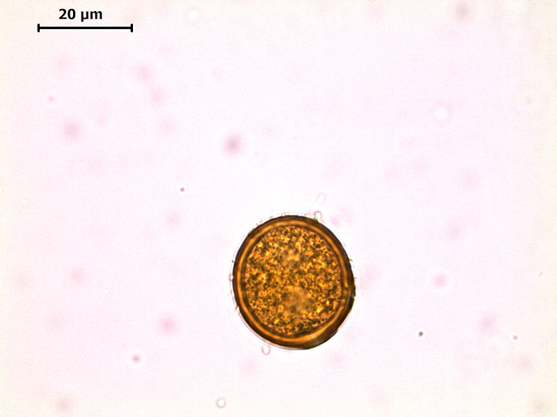 Uromyces_valerianae_6.jpg