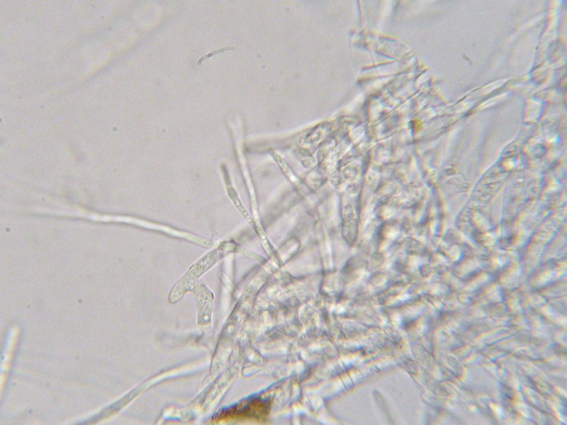 1000er Berchtes (1).jpg